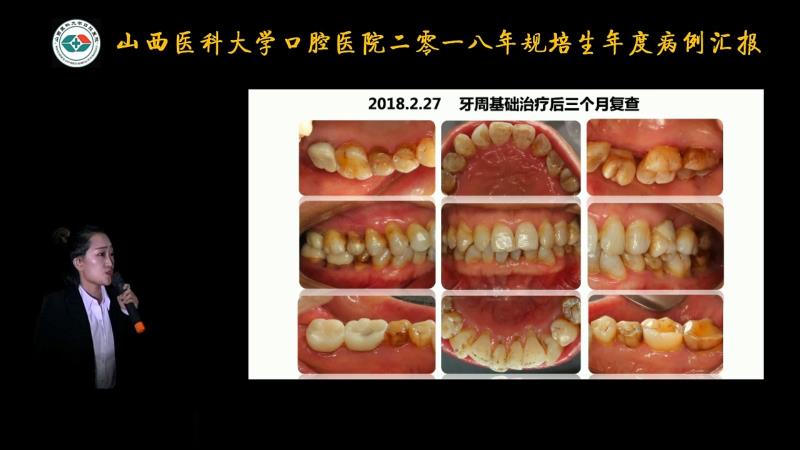 一等獎選手張麗娜在病例匯報